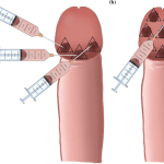 ibogaine-